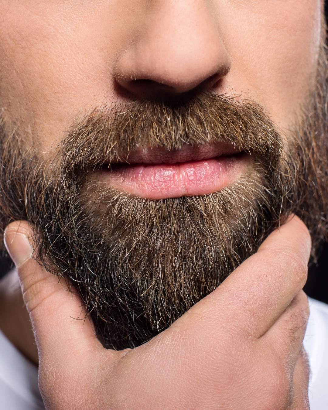 Best Beard Transplant Service in Edmonton