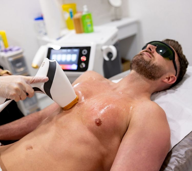 Airdrie Laser Hair Removal – Smooth Skin, Hassle-Free