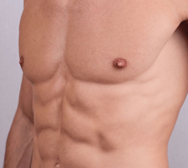 Chest Contouring for Men in Grande Prairie