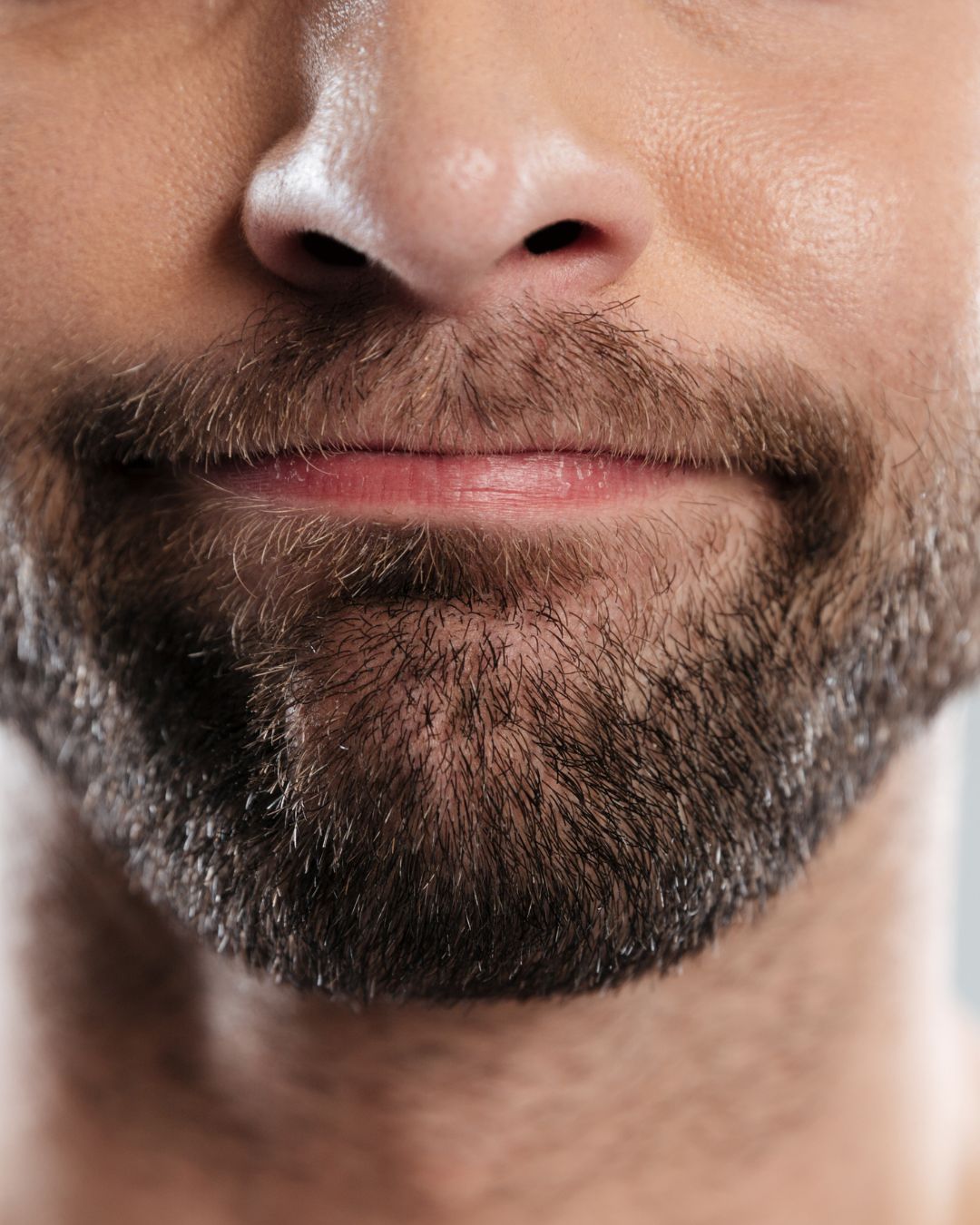 Lethbridge Beard Transplants and Restoration