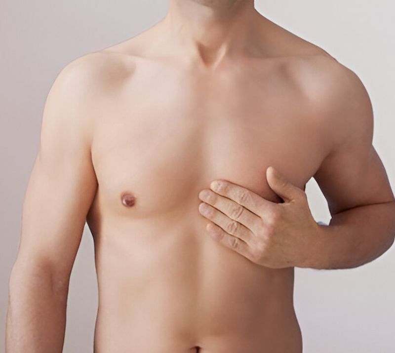 Male Breast Reduction In Strathcona County