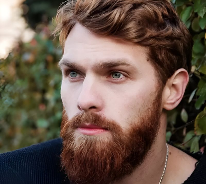 Strathcona County Beard Transplant