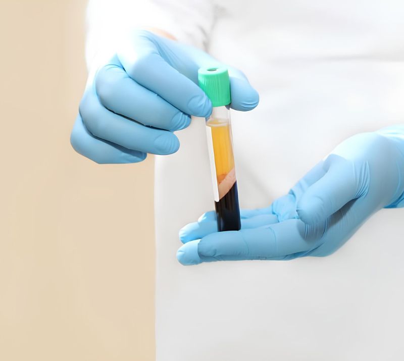 Strathcona County_P-Shot Therapy