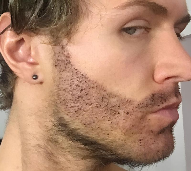 Wood BuFFalo Want A Fuller Beard