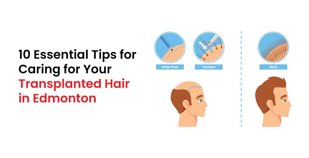Essential Tips for Caring for Your Transplanted Hair